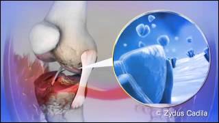 Mechanism of Action [upl. by Phila]