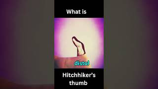 What is Hitchhikers Thumb [upl. by Marten]