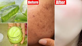 New Aloevera Skin Whitening Face CreamFor Dull Dark SkinPigmentation amp Dark SpotsGet Glowing Skin [upl. by Arzed251]