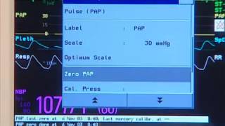 Invasive Pressure Setting up [upl. by Htrag]