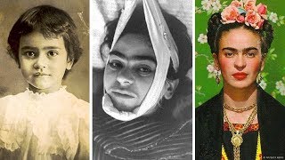 La trágica historia de Frida Kahlo [upl. by Eintrok]