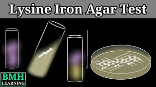 Lysine Iron Agar Test  Lysine Decarboxylase Test [upl. by Einitsed196]