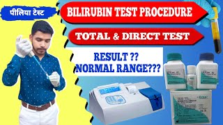 Total amp Direct Bilirubin test procedure practical video पीलिया टेस्टjaundice testserum bilirubin [upl. by Ainwat]