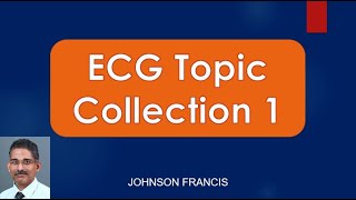 ECG Topic Collection 1 [upl. by Inalak]