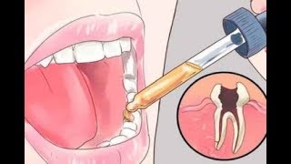 12 All Natural Toothache Remedies Your Dentist Doesn’t Want You to Know About [upl. by Acirret]