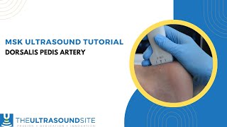 How to find the Dorsalis Pedis artery on MSK ultrasound of the foot [upl. by Nnayllas]