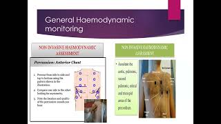 Haemodynamic monitoring Invasive Blood Pressure Measurement [upl. by Nerral673]