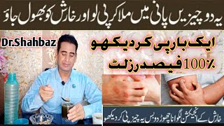 Kharish Khatam Karne Ka Tarika  Kharish Ka Ilaj In Urdu  Itching Treatment  Kharish Ka Fori Ilaj [upl. by Watanabe]