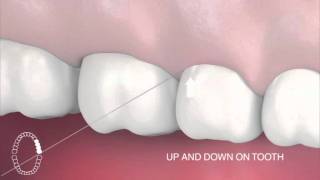 How to use interdental floss [upl. by Einuj935]