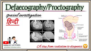 Defaecography  Proctography  Defaecation Proctography  Evacuation Proctography [upl. by Martie]