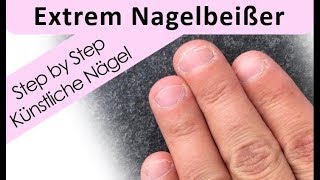 Nagelbeißer Extrem  Nagelmodellage Step by Step [upl. by Atiuqaj226]