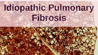 What is Idiopathic Pulmonary Fibrosis  Pathology mini tutorials [upl. by Laup592]