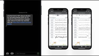 Clarity detected NCSE and Persistent Seizure Activity was Aborted [upl. by Gisser516]