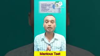 Mantoux Test  TST  PPD Tuberculin Skin Test  Diagnosis of TB shorts tuberculosis shortvideo [upl. by Nosremaj111]