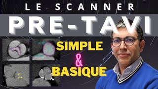 Comment faire un scanner PRETAVI  Simple amp Basique [upl. by Aneetsirk819]