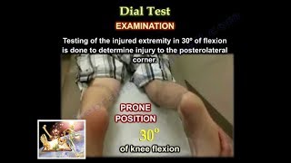 Dial Test  Everything You Need To Know  Dr Nabil [upl. by Eiba351]