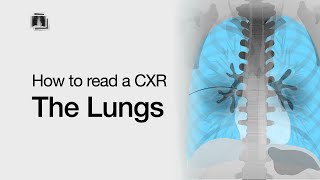 How to Read a Chest XRay The Lungs [upl. by Elfrida]