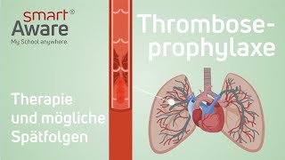 Thromboseprophylaxe Therapie und mögliche Spätfolgen  Fachfortbildungen in der Pflege  smartAware [upl. by Nosaes]