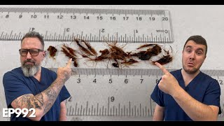 INSANE Amount Of Hair Removed From My Ear Canal  EP992 [upl. by Tuesday]