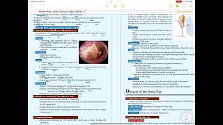 Secretory otitis media [upl. by Kcinnay]