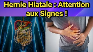 Hernie Hiatale  Symptômes Types et Traitements – Comprendre cette pathologie fréquente [upl. by Blum]