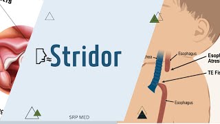 StridorDefinitionTypesMechanism [upl. by Nolrev616]