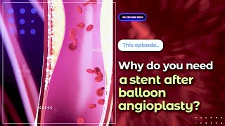 Why do you need a stent after balloon angioplasty [upl. by Debi]