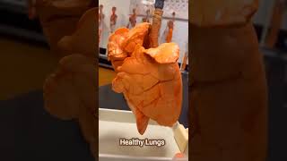 Healthy lungs VS Smoked lungs motivation neet2024 neet mbbs mbbs medical bams [upl. by Jehoash]