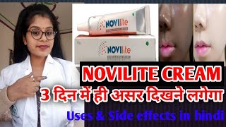 Novilite Skin Cream honest review  Novilite Skin Cream benefits Uses amp side effects in hindi [upl. by Liddie]