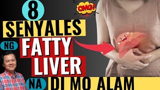 8 Senyales ng Fatty Liver na Di Mo Alam  by Doc Willie Ong [upl. by Groves]