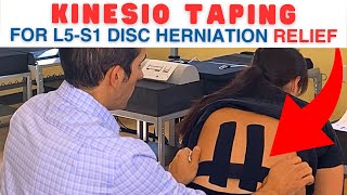 Kinesio Taping for L5S1 Herniated Disc L5S1 Disc Herniation  Dr Marc Dupuis Chiropractor [upl. by Apeed500]