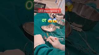 OT cardiac arrest 😱😱shorts ytshorts trending emergency [upl. by Nich874]