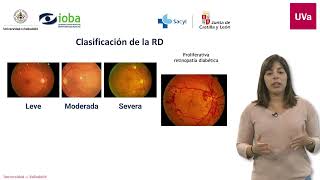 Programa de cribado de retinopatía diabética [upl. by Ettennod]