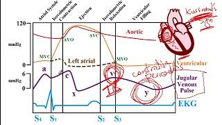 USMLE ACE Video 120 Wigger and FrankStarling Diagram [upl. by Nahaj]