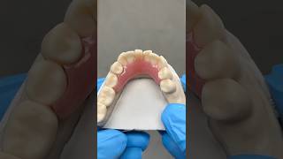 Lower Flipper Partial ​⁠EnvisiontecMain envisiontec lsk121shorts dentist teeth [upl. by Greenlee]