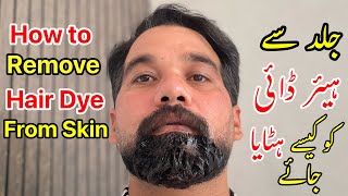 How to Remove Hair Dye at Home DIY Hair Dye Remover [upl. by Clarkson215]