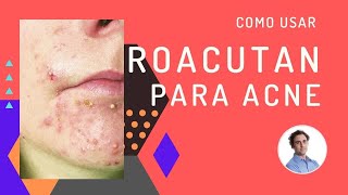 Como usar isotretinoina e roacutan para acne e espinhas [upl. by Heddi]