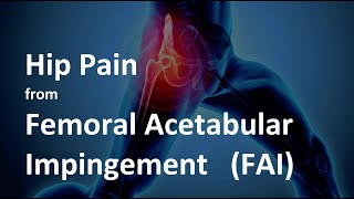 Hip Pain from Femoral Acetabular Impingement FAI  What is it and how to treat it [upl. by Annawd]