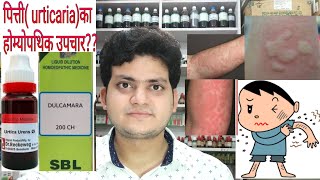 Urticaria Homeopathic medicine for Urticaria explain [upl. by Sondra594]