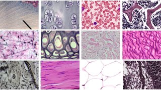 Practice Identifying Connective Tissue Complete [upl. by Ynohtnakram507]