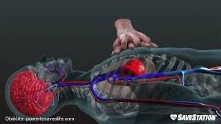 SLOVENIAN Kako poteka kardiopulmonalno oživljanje  3D pogled v notranjost telesa [upl. by Branham303]