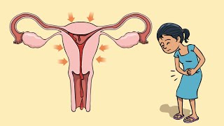 What are period cramps and how to deal with them [upl. by Nhguavad]