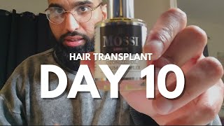 Day 10 Hair Transplant Journey  Some Normality 😌 [upl. by Fairman693]