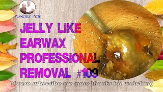 Expert Earwax Removal Techniques You Need to Know [upl. by Averir]