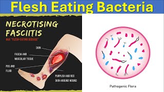 What Are Flesh Eating Bacteria  Causes Symptoms and Treatments Of Necrotizing Fasciitis [upl. by Elmajian]