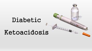 Diabetic Ketoacidosis DKA [upl. by Farlay]