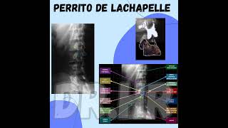 Columna lumbar perro LaChapelle medicina columna columnavertebral lumbar radiografia shorts [upl. by Adena497]