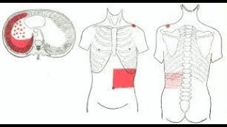 Why Pleurisy pain  Pleuritis pain is referred to the anterior abdominal wall [upl. by Ameerak]