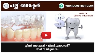 ക്ലിയർ അലൈനർ ചിലവ് എത്രയാണ്  Cost of Clear Aligner  Video By DrThomas Nechupadam [upl. by Haliak]