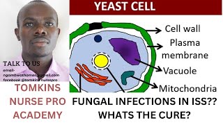 ANTIFUNGAL MEDICATION SIMPLIFIED [upl. by Lemaceon]